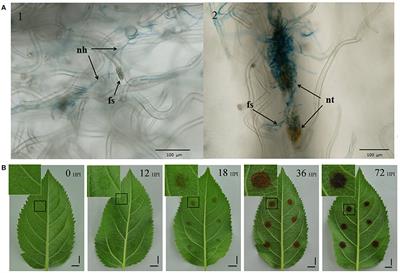 Transcriptomics Analysis of Apple Leaves in Response to <mark class="highlighted">Alternaria alternata</mark> Apple Pathotype Infection